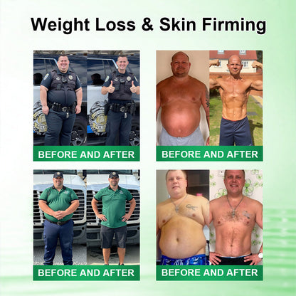 𝑶𝒇𝒇𝒊𝒄𝒊𝒂𝒍 𝑺𝒕𝒐𝒓𝒆  |🍀🍀𝐃𝐑.𝐇𝐎𝐍𝐎𝐑® 𝐋𝐲𝐦𝐩𝐡𝐚𝐭𝐢𝐜 𝐃𝐫𝐚𝐢𝐧𝐚𝐠𝐞 𝐒𝐥𝐢𝐦𝐦𝐢𝐧𝐠 𝐍𝐚𝐧𝐨-𝐌𝐢𝐜𝐫𝐨𝐧𝐞𝐞𝐝𝐥𝐞 𝐏𝐚𝐭𝐜𝐡 🇺🇸 (𝐉𝐮𝐬𝐭 𝐨𝐧𝐜𝐞 𝐚 𝐝𝐚𝐲, 𝐯𝐢𝐬𝐢𝐛𝐥𝐞 𝐜𝐡𝐚𝐧𝐠𝐞𝐬 𝐢𝐧 𝟕 𝐝𝐚𝐲𝐬）𝘽𝙚𝙧𝙗𝙚𝙧𝙞𝙣𝙚 + 𝙈𝙤𝙧𝙞𝙣𝙜𝙖 𝙁𝙤𝙧𝙢𝙪𝙡𝙖 ✅ 𝐅𝐨𝐫 𝐨𝐛𝐞𝐬𝐢𝐭𝐲, 𝗟𝗼𝗼𝘀𝗲 𝘀𝗸𝗶𝗻,𝐝𝐢𝐚𝐛𝐞𝐭𝐞𝐬, 𝐬𝐥𝐞𝐞𝐩 𝐚𝐩𝐧𝐞𝐚, 𝐣𝐨𝐢𝐧𝐭 𝐢𝐬𝐬𝐮𝐞𝐬, 𝐚𝐧𝐝 𝐦𝐨𝐫𝐞💯💯