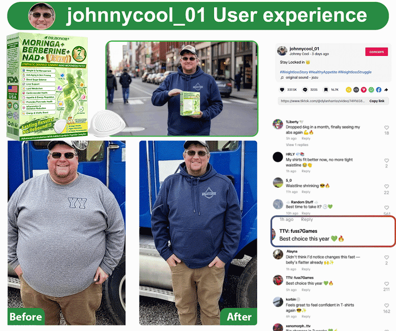𝑶𝒇𝒇𝒊𝒄𝒊𝒂𝒍 𝑺𝒕𝒐𝒓𝒆  |🍀🍀𝐃𝐑.𝐇𝐎𝐍𝐎𝐑® 𝐋𝐲𝐦𝐩𝐡𝐚𝐭𝐢𝐜 𝐃𝐫𝐚𝐢𝐧𝐚𝐠𝐞 𝐒𝐥𝐢𝐦𝐦𝐢𝐧𝐠 𝐍𝐚𝐧𝐨-𝐌𝐢𝐜𝐫𝐨𝐧𝐞𝐞𝐝𝐥𝐞 𝐏𝐚𝐭𝐜𝐡 🇺🇸 (𝐉𝐮𝐬𝐭 𝐨𝐧𝐜𝐞 𝐚 𝐝𝐚𝐲, 𝐯𝐢𝐬𝐢𝐛𝐥𝐞 𝐜𝐡𝐚𝐧𝐠𝐞𝐬 𝐢𝐧 𝟕 𝐝𝐚𝐲𝐬）𝘽𝙚𝙧𝙗𝙚𝙧𝙞𝙣𝙚 + 𝙈𝙤𝙧𝙞𝙣𝙜𝙖 𝙁𝙤𝙧𝙢𝙪𝙡𝙖 ✅ 𝐅𝐨𝐫 𝐨𝐛𝐞𝐬𝐢𝐭𝐲, 𝗟𝗼𝗼𝘀𝗲 𝘀𝗸𝗶𝗻,𝐝𝐢𝐚𝐛𝐞𝐭𝐞𝐬, 𝐬𝐥𝐞𝐞𝐩 𝐚𝐩𝐧𝐞𝐚, 𝐣𝐨𝐢𝐧𝐭 𝐢𝐬𝐬𝐮𝐞𝐬, 𝐚𝐧𝐝 𝐦𝐨𝐫𝐞💯💯